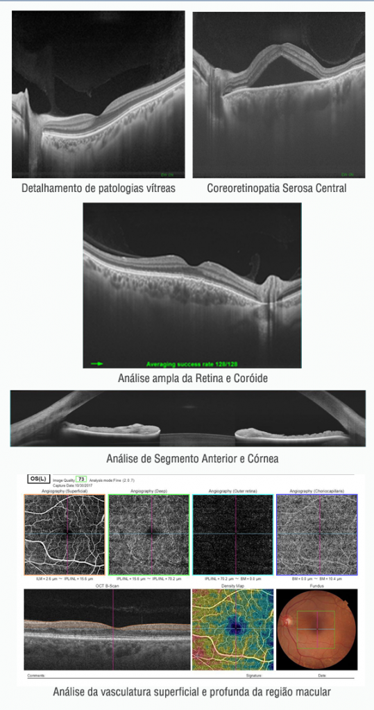 angio-oct-exames