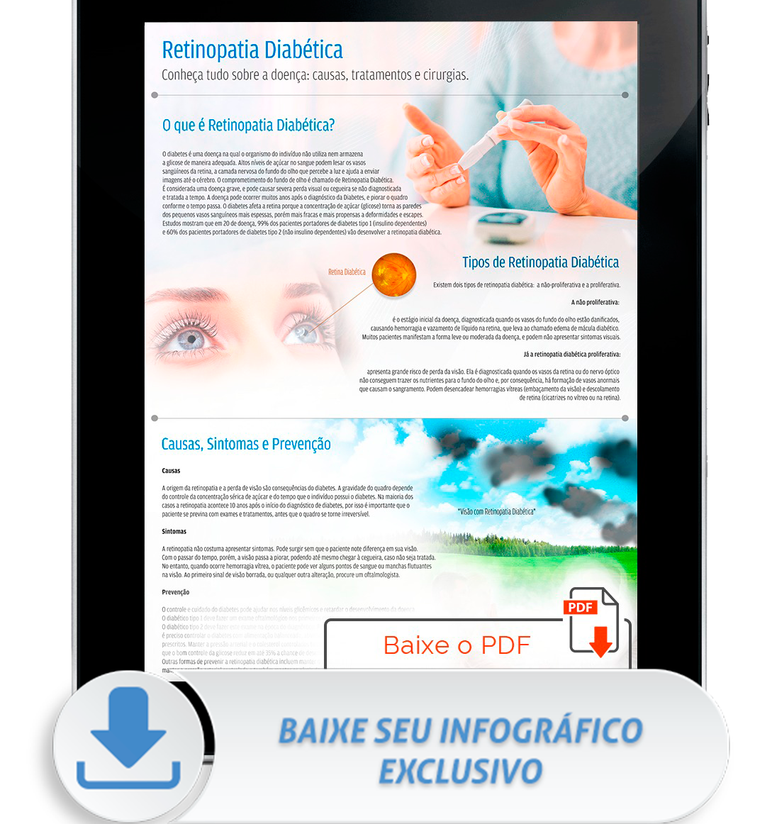 infografico-retinopatia-neo Guia Completo Sobre Retinopatia Diabética