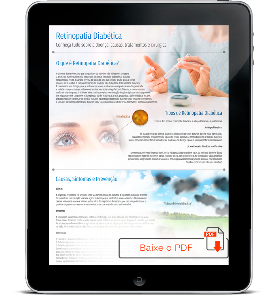 guia-completo-sobre-a-retinopatia-diabetica